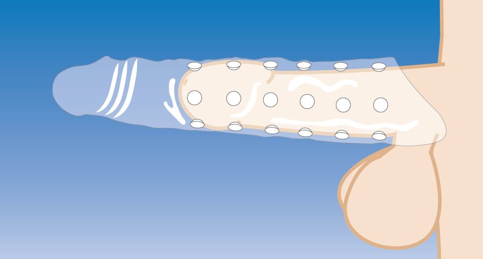 Extender Penis Sleeve With Nubs - Light Skin